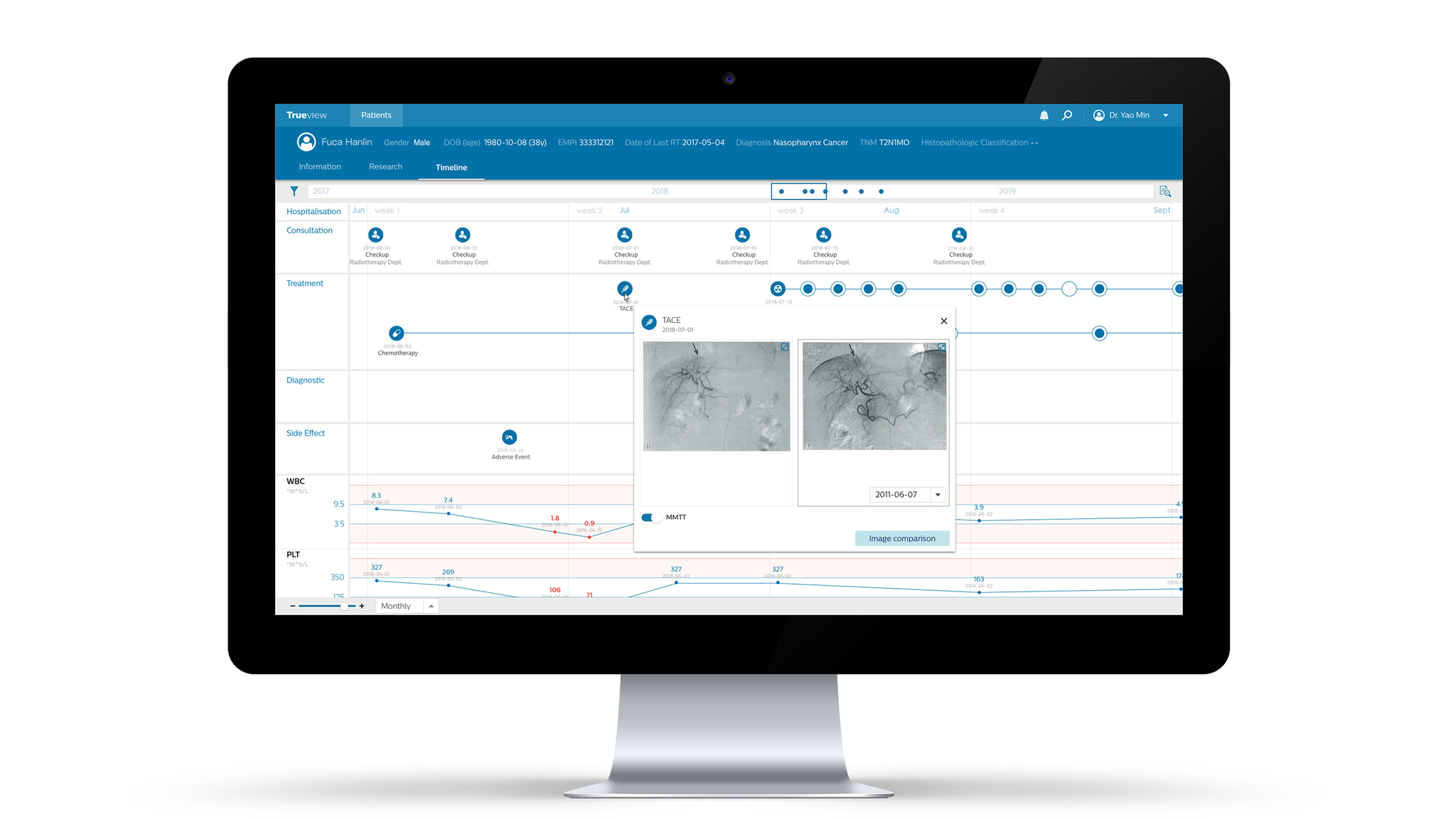 Intellispace Oncology Management