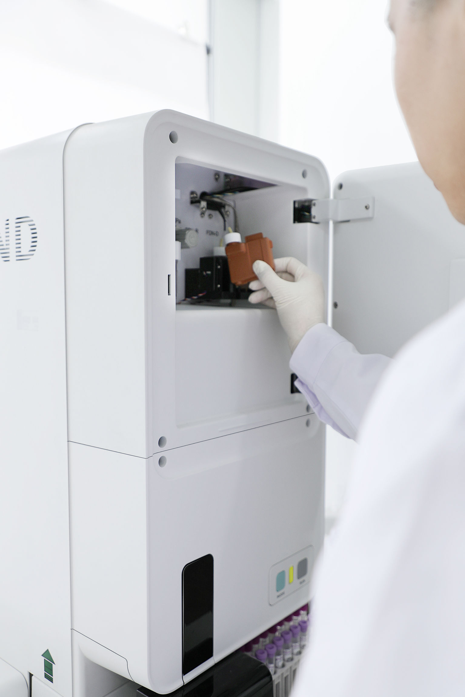 5-Part Auto Hematology Analyzer