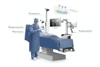 Continuous Tracking Surgical Assistance System