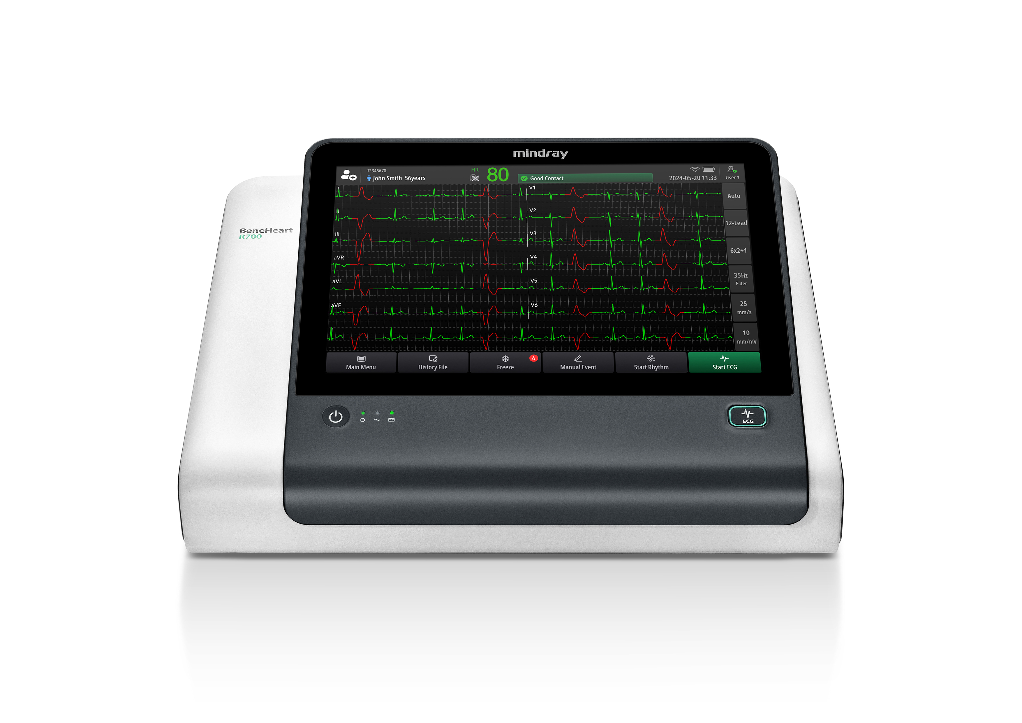 Beneheart R series smart ECG