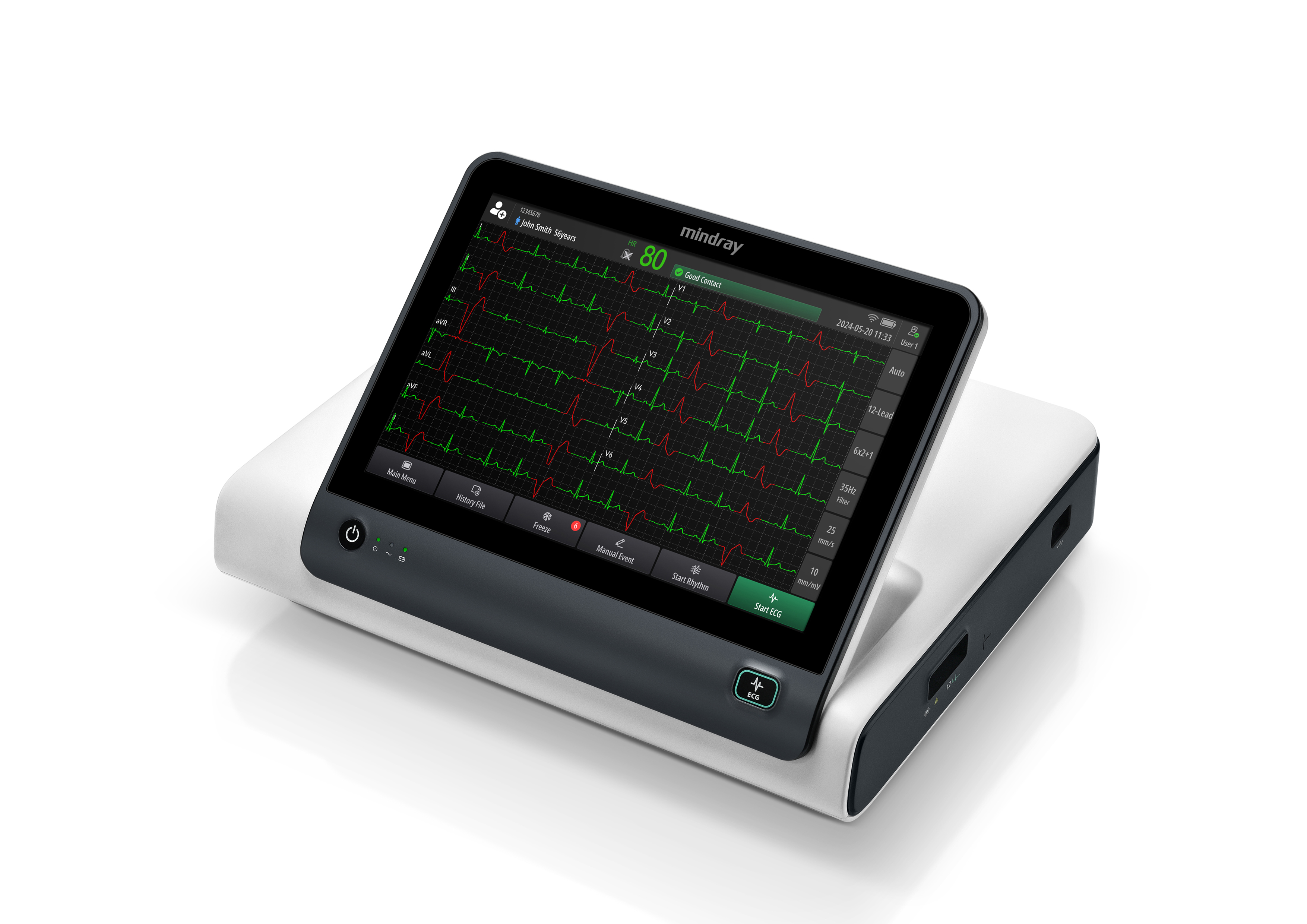 Beneheart R series smart ECG