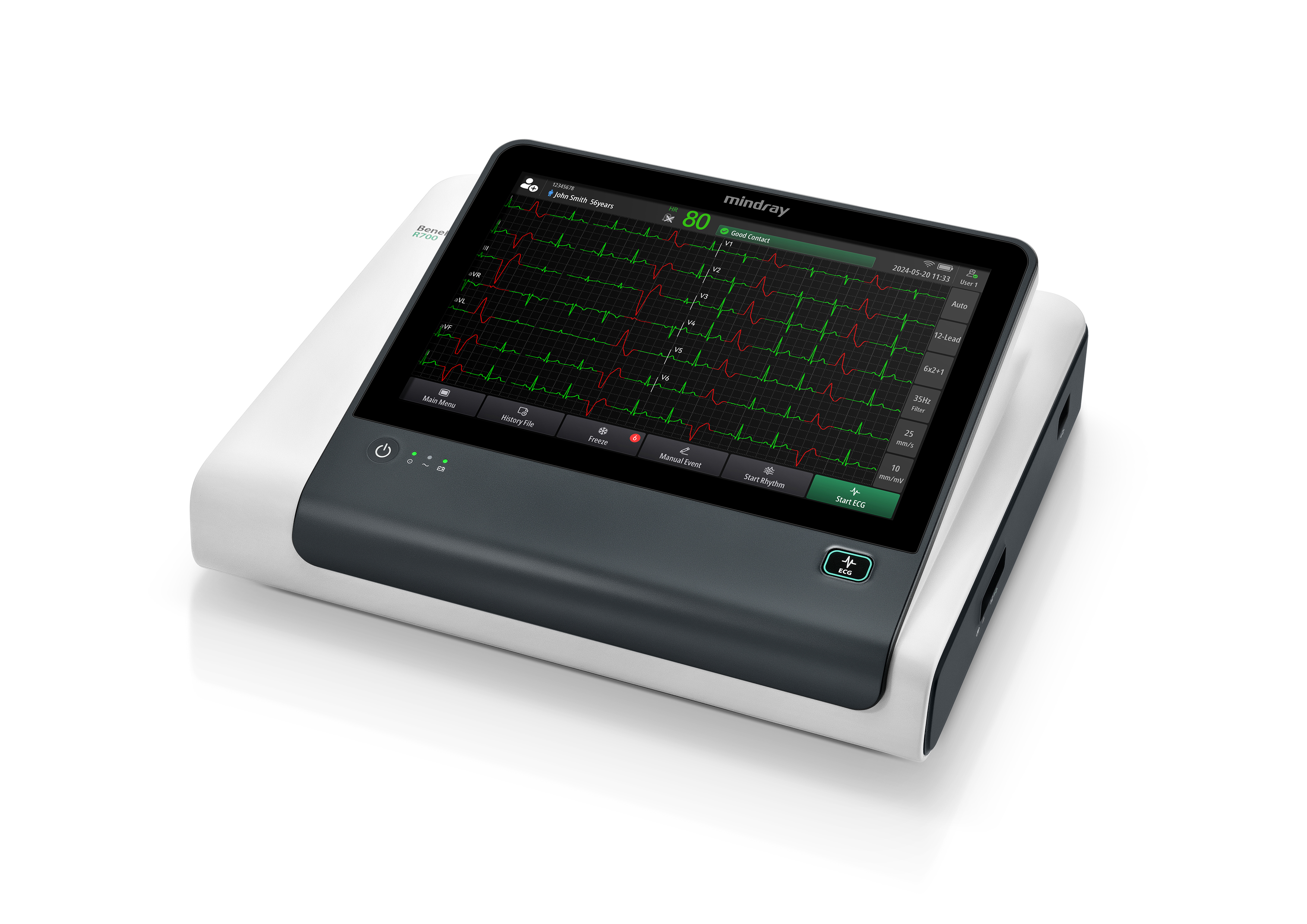 Beneheart R series smart ECG