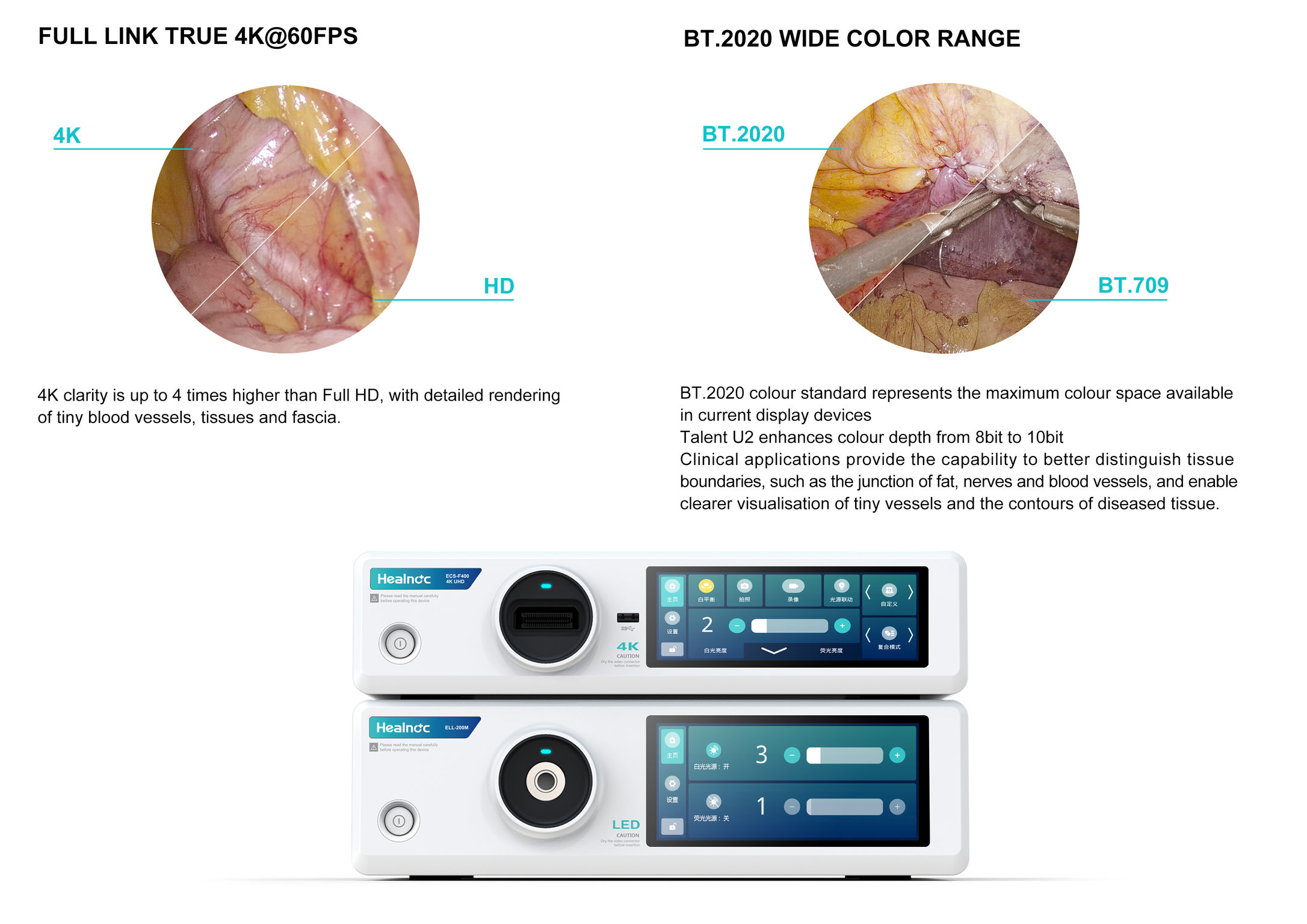 Talent U2 Endoscopy System