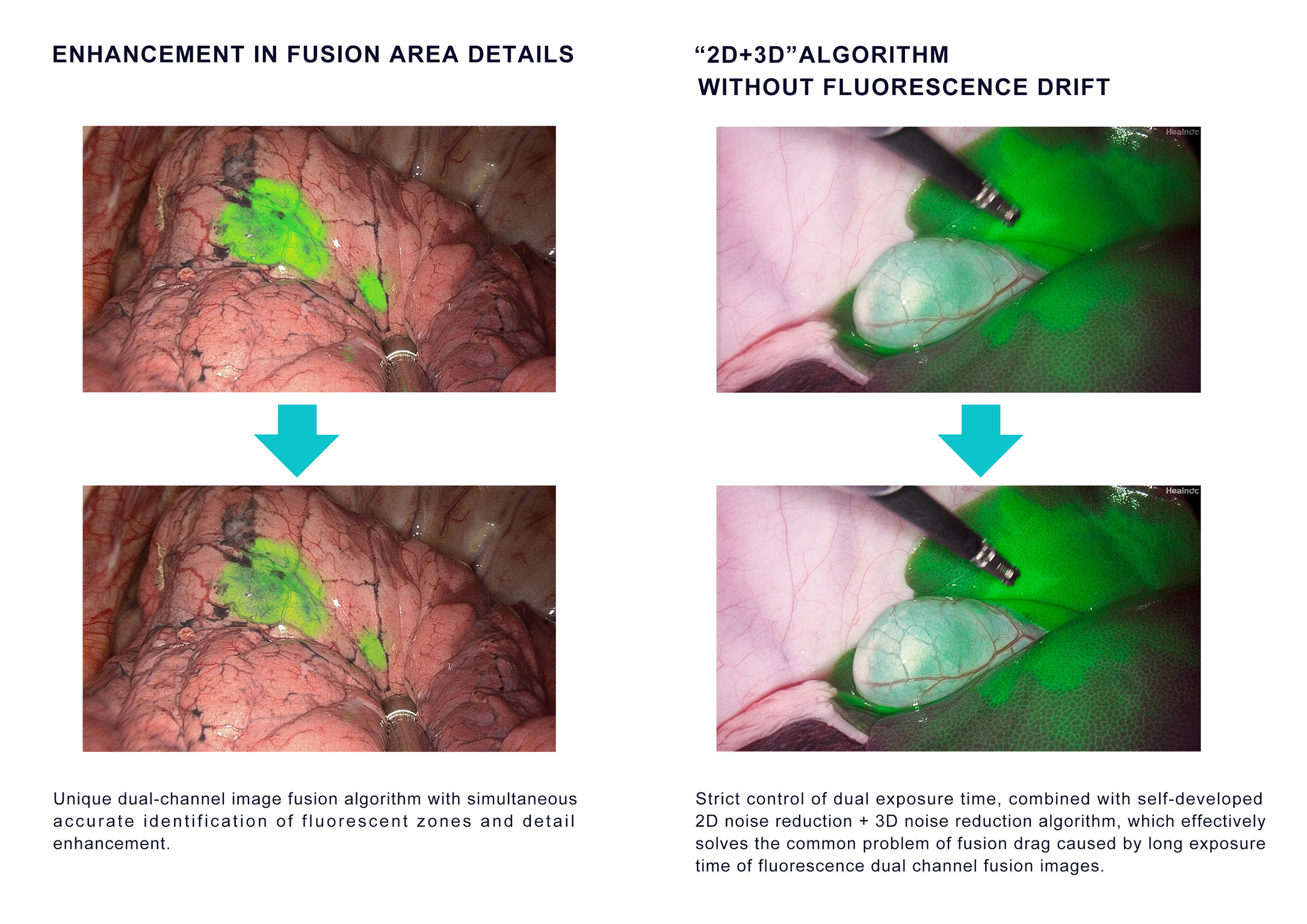 Talent U2 Endoscopy System