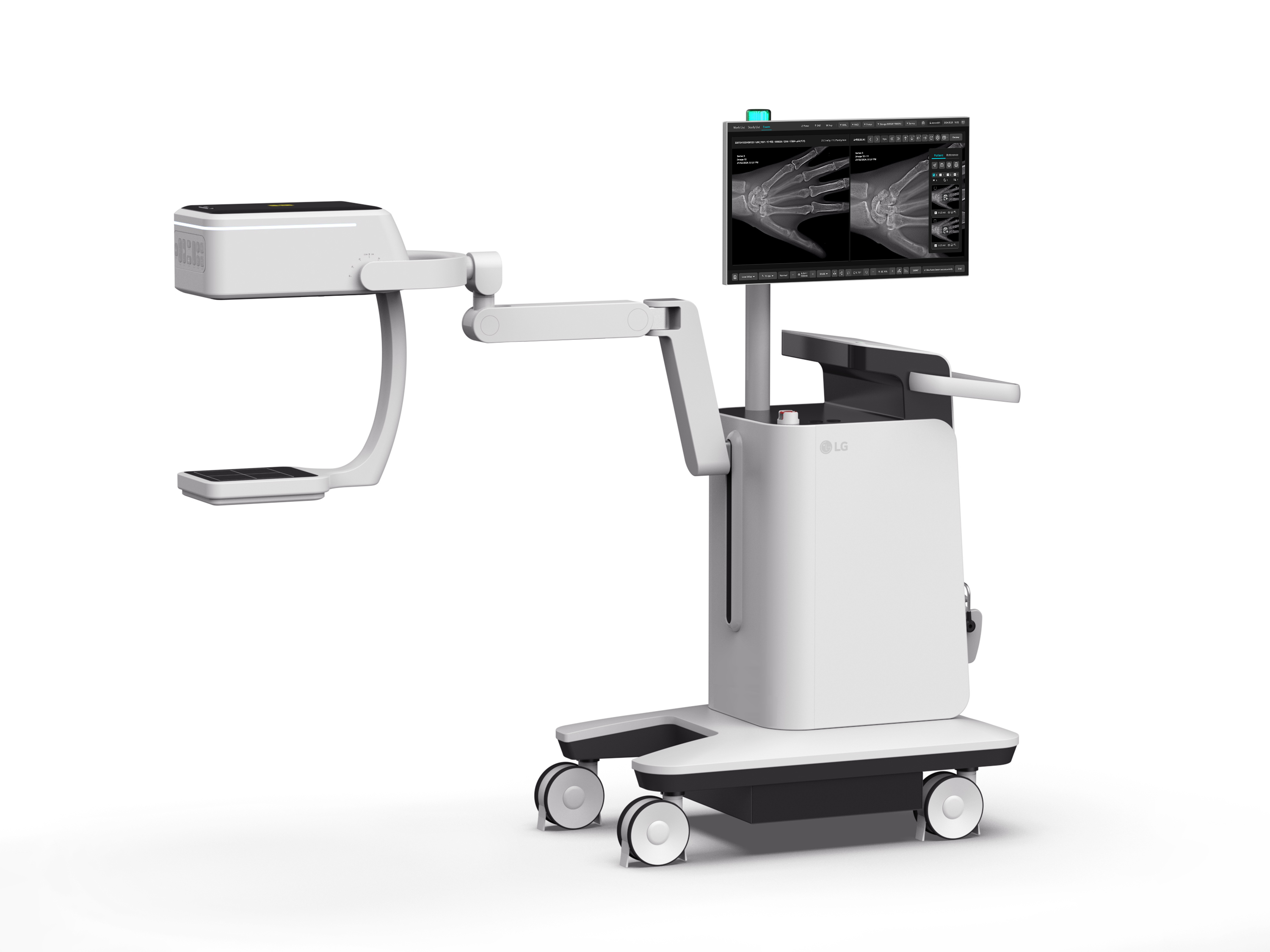 LG FTscan