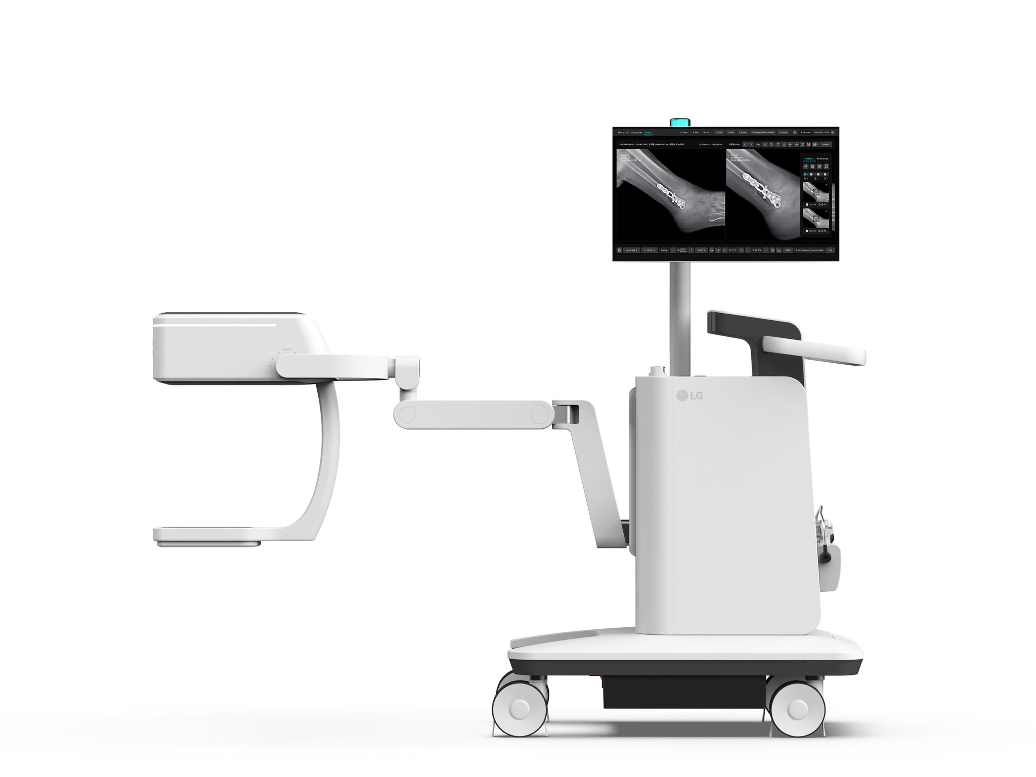 LG FTscan